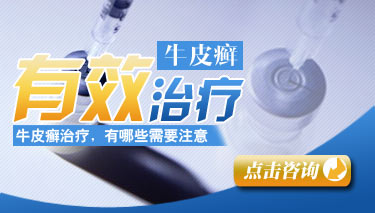 牛皮癣久治不愈怎么办